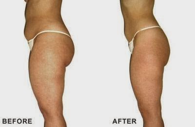 Latino Tattoo & Hair Removal | 6320 28 Ave NE, Calgary, AB T1Y 4K7, Canada | Phone: (403) 404-8088