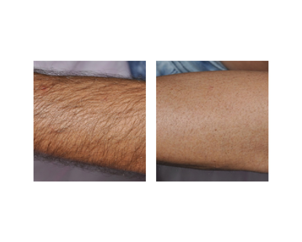 Laser And Lash Clinic | 633 King St E unit# 206, Oshawa, ON L1H 1G3, Canada | Phone: (416) 896-5274