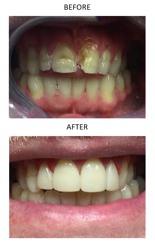 Maplewood Dental | 75 Barrie View Dr #105, Barrie, ON L4N 8V4, Canada | Phone: (705) 733-0003