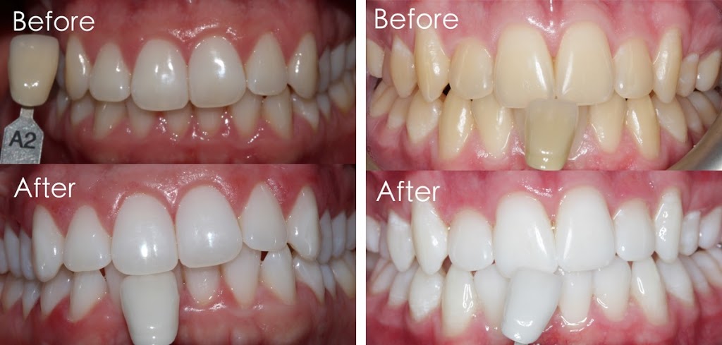Dental Arts Clinic | 3175 Rutherford Rd unit 36, Concord, ON L4K 5Y6, Canada | Phone: (905) 761-1181