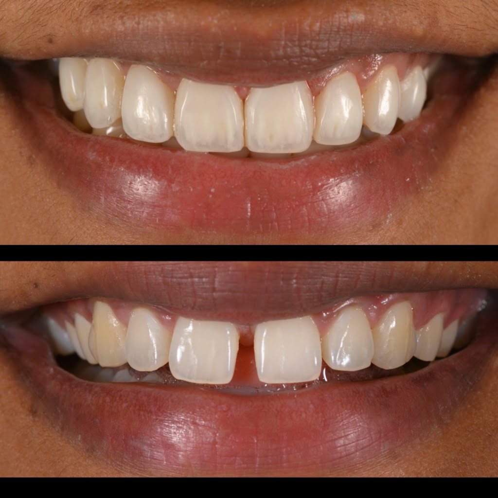 R Dentists | 6733 Mississauga Rd Suite102, Mississauga, ON L5N 6J5, Canada | Phone: (905) 567-6757