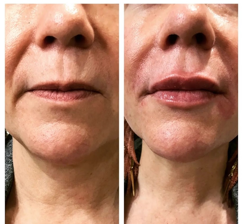 Eternal Beauty Enhancements | 148 Third St, Bowmanville, ON L1C 2C4, Canada | Phone: (905) 449-5167