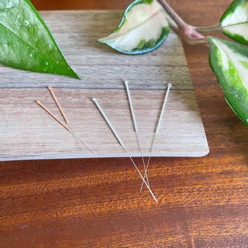 Bowness Acupuncture | Bonita Crescent NW, Calgary, AB T3B 2R9, Canada | Phone: (403) 988-3929