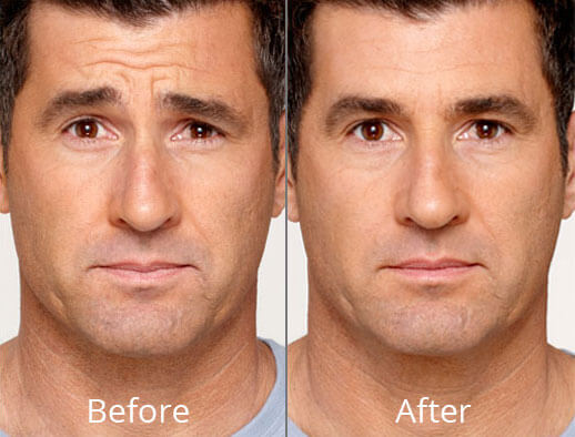Clini-Derma | 3498 Bd Sainte-Rose, Laval, QC H7P 4K7, Canada | Phone: (514) 332-4545