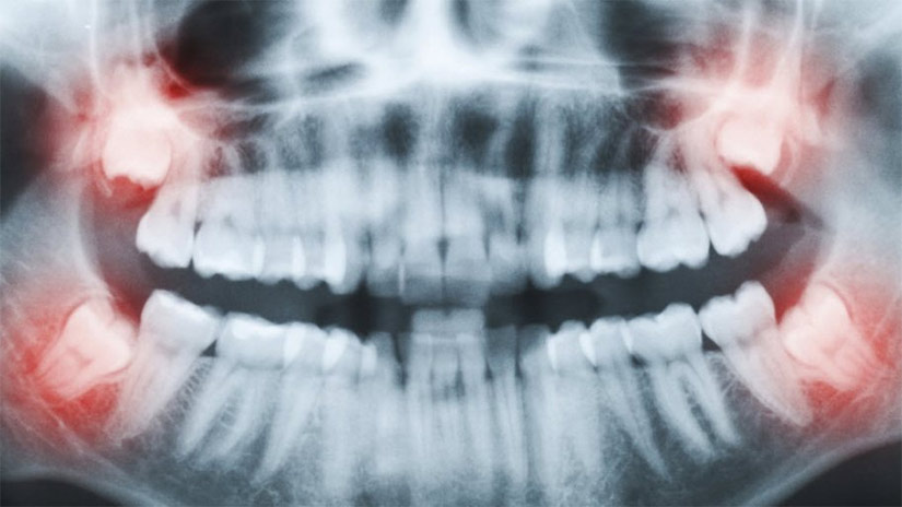 Smiles Dentistry | 1648 Bloor St W #1, Toronto, ON M6P 1A7, Canada | Phone: (416) 588-8004