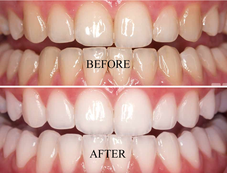 Tooth Care Centre | 6061 York Regional Rd 7, Markham, ON L3P 3B2, Canada | Phone: (905) 554-3555