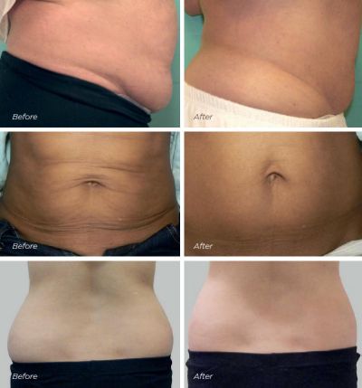 CliniSpa Saint-Bruno | 1071 Boulevard Saint-Bruno, Saint-Bruno-de-Montarville, QC J3V 6P4, Canada | Phone: (450) 653-0505
