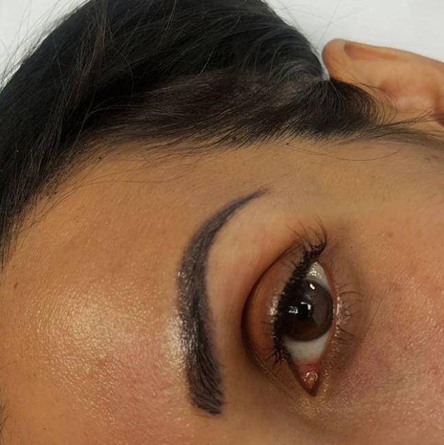 Medspa By Terezia | 200 Matheson Blvd W #104b, Mississauga, ON L5R 3L7, Canada | Phone: (416) 836-5500