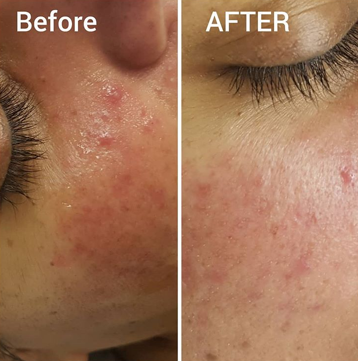 Medspa By Terezia | 200 Matheson Blvd W #104b, Mississauga, ON L5R 3L7, Canada | Phone: (416) 836-5500