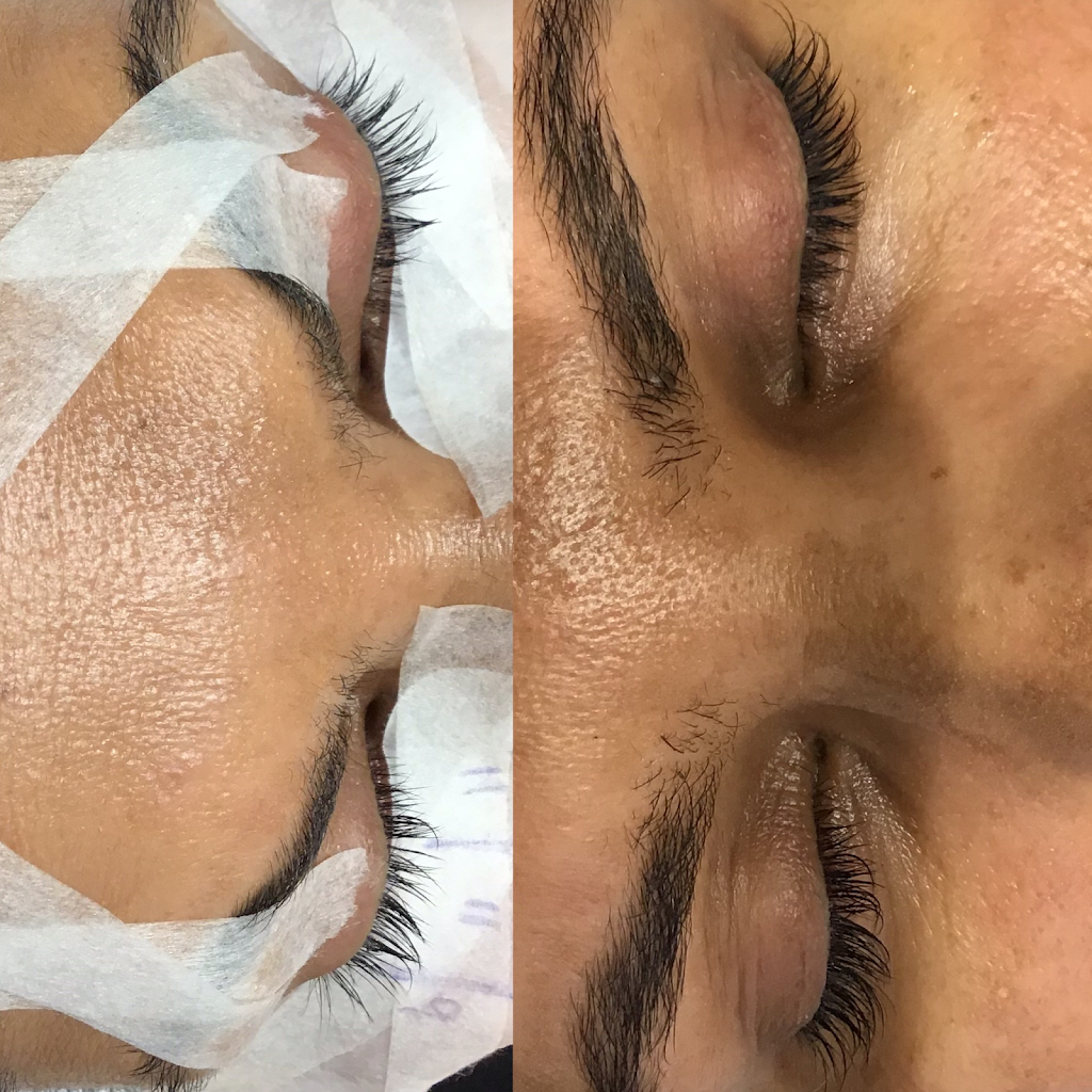 Beauty First Spa | 9350 Yonge St Unit# G004, Richmond Hill, ON L4C 5G2, Canada | Phone: (905) 884-9000