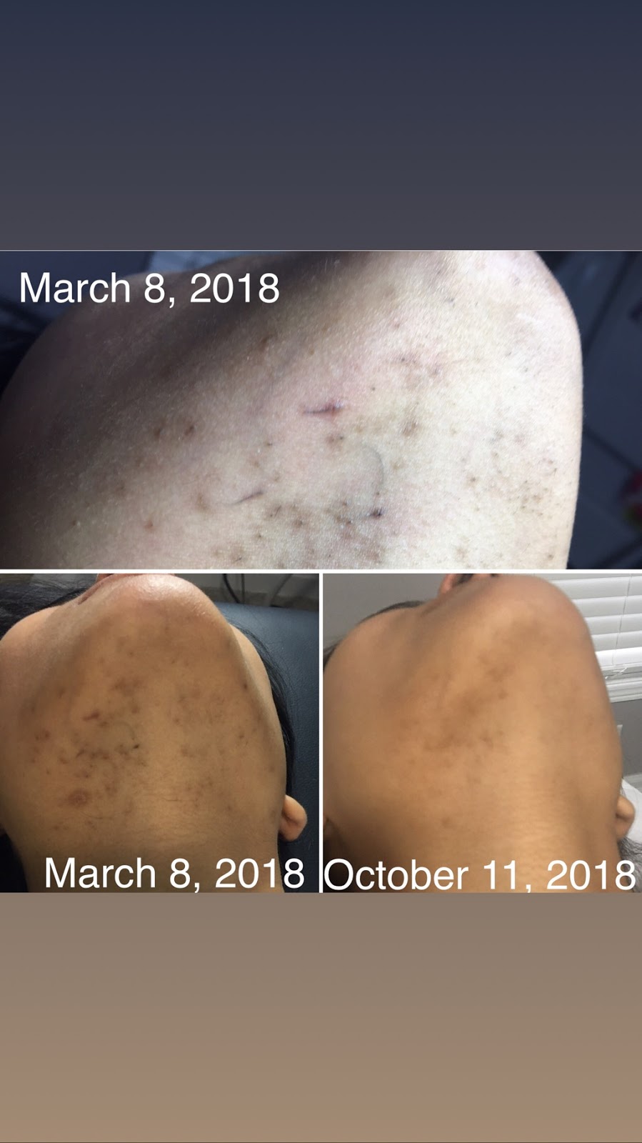 Skin 2 Envy Laser Med Spa | 3 Cox Crescent, Brampton, ON L6X 3H1, Canada | Phone: (416) 892-6792