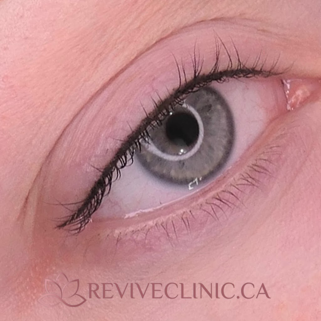 Revive Clinic Cosmetic Tattooing | 106 Wellman Crescent, Saskatoon, SK S7T 0J1, Canada | Phone: (306) 262-3282