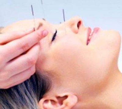WellnessRising Acupuncture Massage Clinic | 107-8708 155 St NW, Edmonton, AB T5R 1W2, Canada | Phone: (780) 667-7780