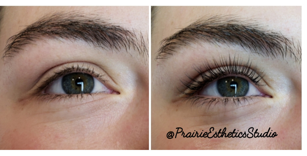 Prairie Esthetics Studio | 3 Torrington Rd, Winnipeg, MB R3Y 1B4, Canada | Phone: (204) 999-0229