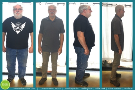 Ideal Wellness | 8 Bellwether Way, Bellingham, WA 98225, USA | Phone: (360) 325-5257