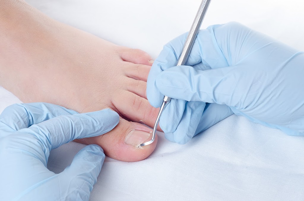 Trinity Foot Care | 3537 Summit Dr, Abbotsford, BC V2T 6S4, Canada | Phone: (604) 996-1823