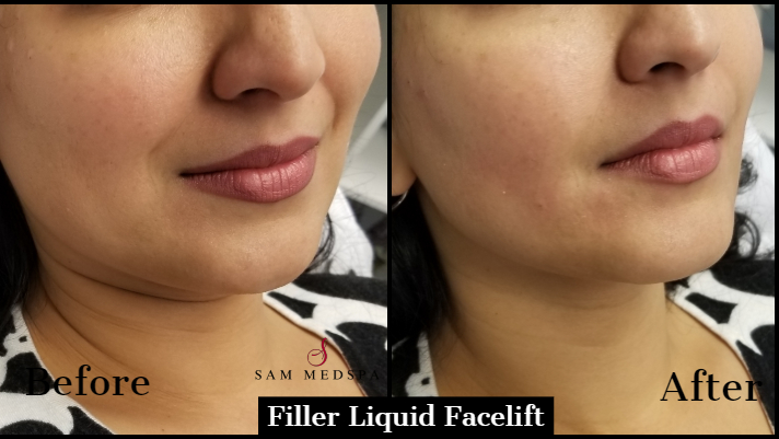 Sam Medspa | 377 Burnhamthorpe Rd E Suite #108, Second floor Central Parkway Mall, Mississauga, ON L5A 3Y1, Canada | Phone: (437) 778-1829