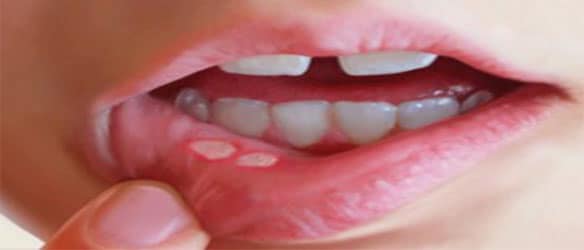Whites Road Dental Care - Dr Gordon Bunt | 14 Whites Rd, Trenton, ON K8V 5P5, Canada | Phone: (613) 392-4757