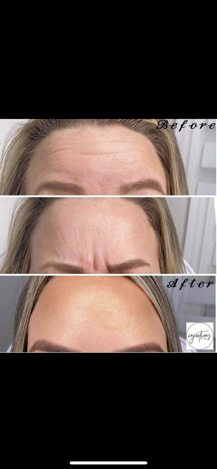Solange Medical Aesthetics | 1051 Upper James St suite 203, Hamilton, ON L9C 3A6, Canada | Phone: (289) 244-8492