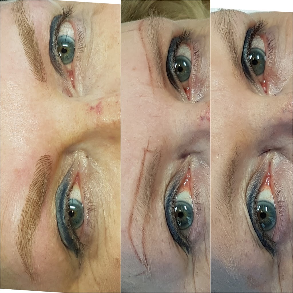 Prestige Laser & Beauty Studio | 6813 Kingsway, Burnaby, BC V3E 1E4, Canada | Phone: (604) 553-3433