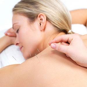 Acupuncture Barrie | 145 Blake St, Barrie, ON L4M 1K4, Canada | Phone: (705) 794-7281