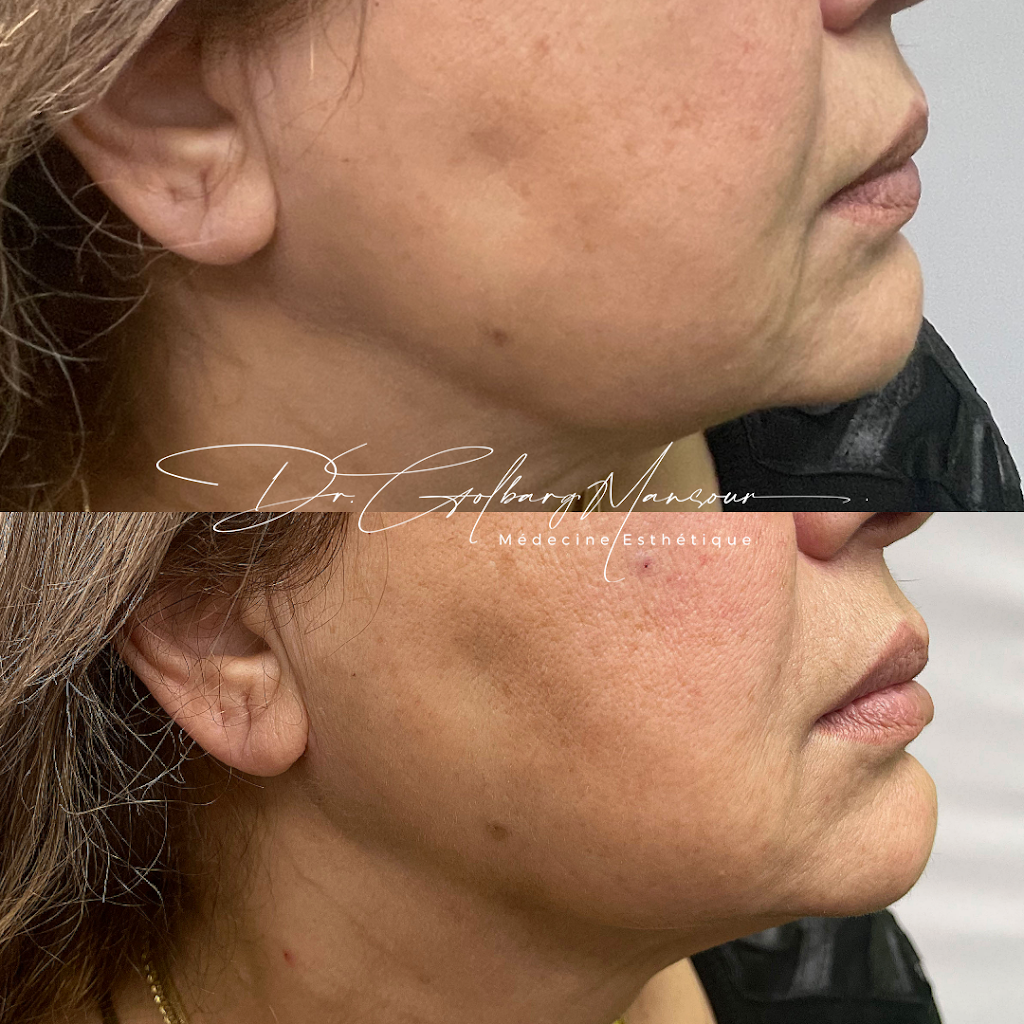 Clinique Esthétique HoMa - Dr. Golbarg Mansour | 4514 Rue Sainte-Catherine E, Montréal, QC H1V 1Y5, Canada | Phone: (514) 500-5805