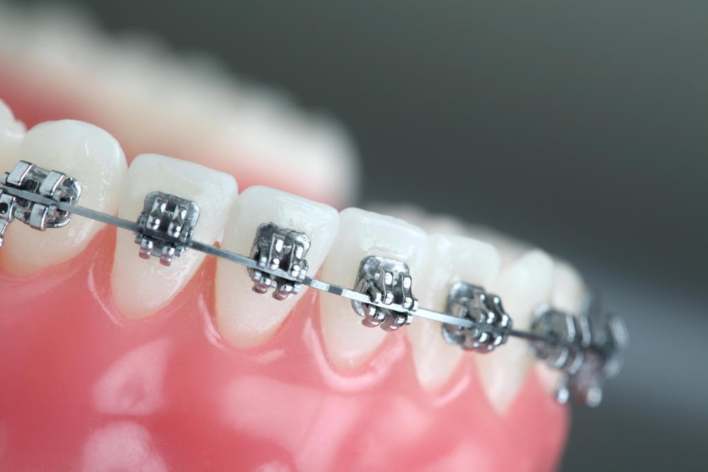 Trio Dentistry | 3163 Winston Churchill Blvd, Mississauga, ON L5L 2W1, Canada | Phone: (905) 812-1818