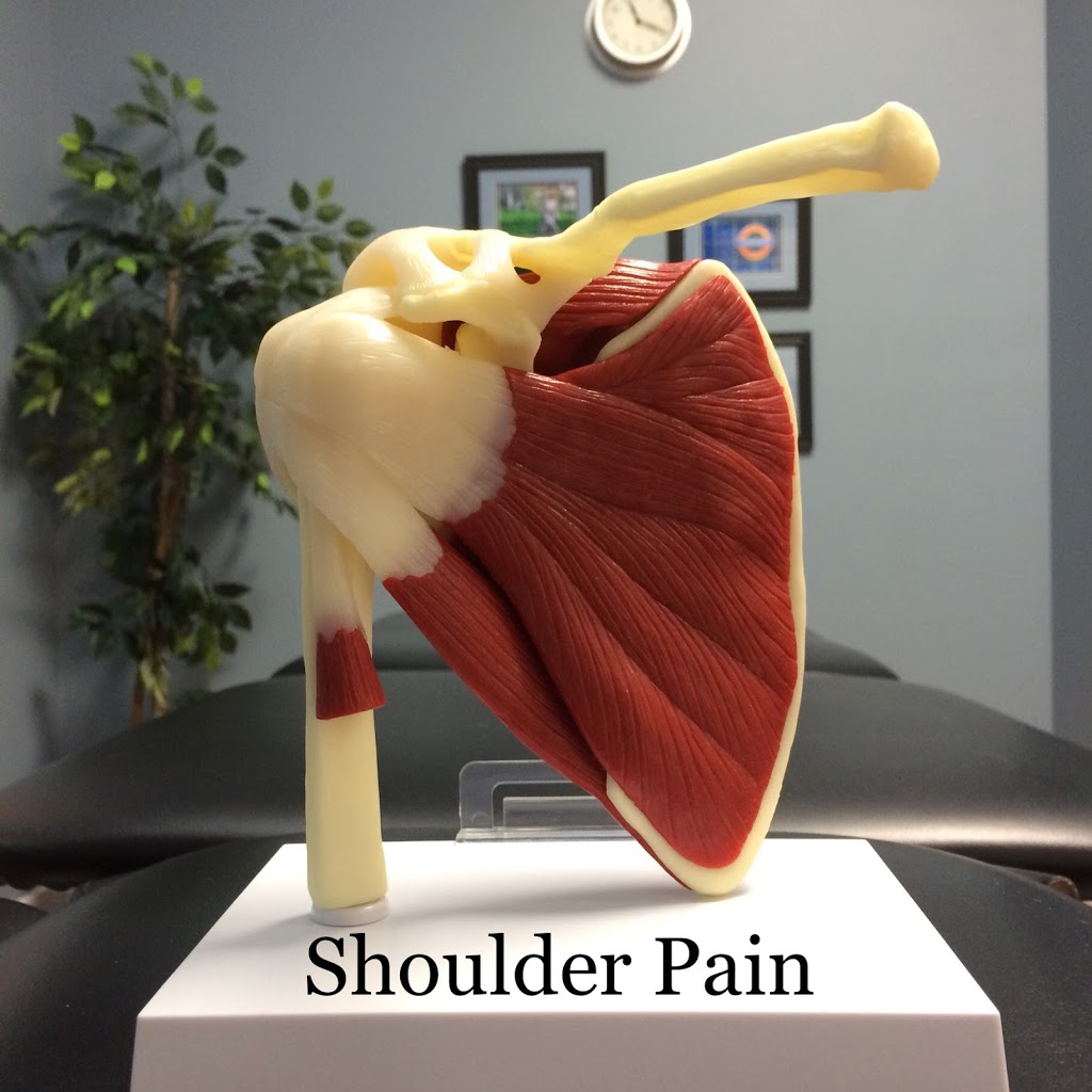 CSA Physiotherapy South Edmonton | 10947 23 Ave NW, Edmonton, AB T6J 7B9, Canada | Phone: (780) 988-5803