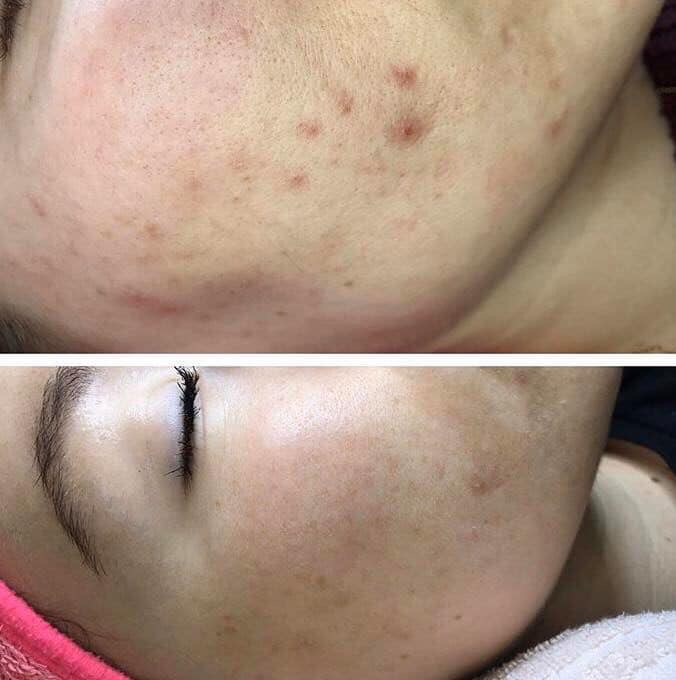 Regardez-moi esthétique | 5060 Rue de Bellechasse, Montréal, QC H1T 2A2, Canada | Phone: (438) 826-9488