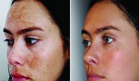 Jenny Palma Medical Aesthetics: Facelifts and Body Contouring Cl | 2261 Bloor St W 2nd Floor, Toronto, ON M6S 1N8, Canada | Phone: (647) 966-7546