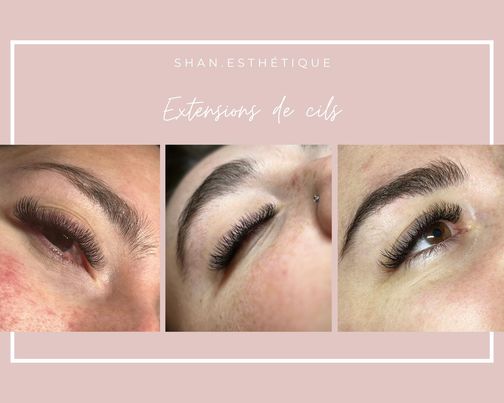 Shan.Esthétique | 3500 Rue des Fadets, Longueuil, QC J3Y 0H3, Canada | Phone: (514) 651-1752