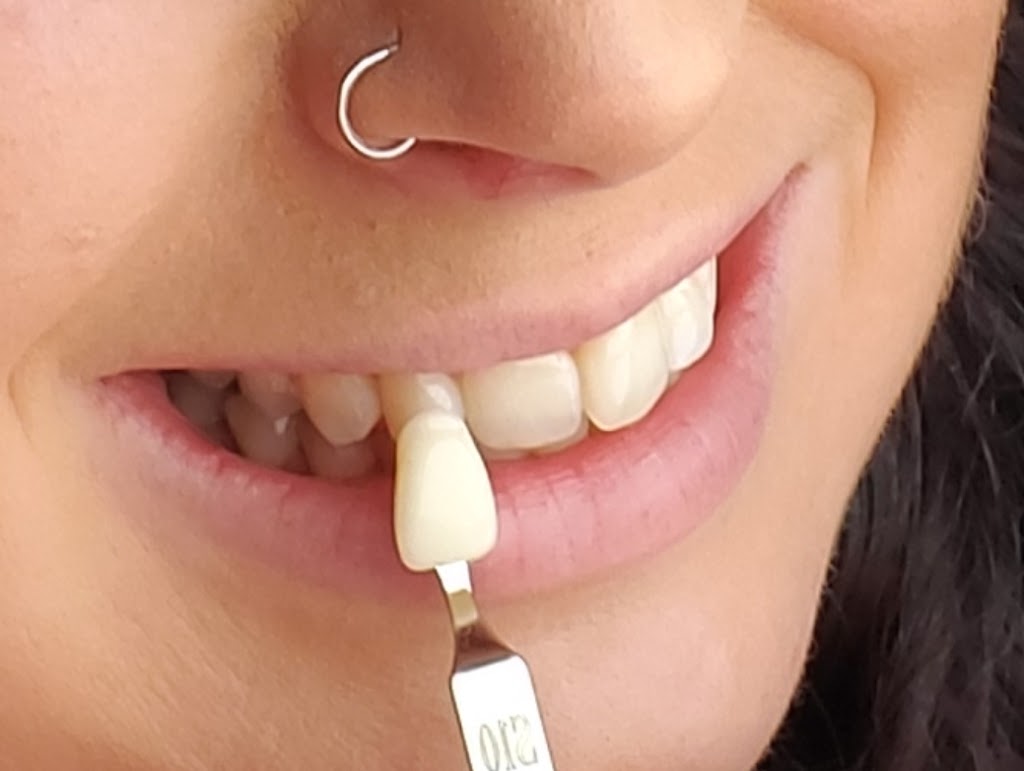 Whitening At Tiffanys | 46 Hannon Cres, Hannon, ON L0R 1P0, Canada | Phone: (905) 920-1398