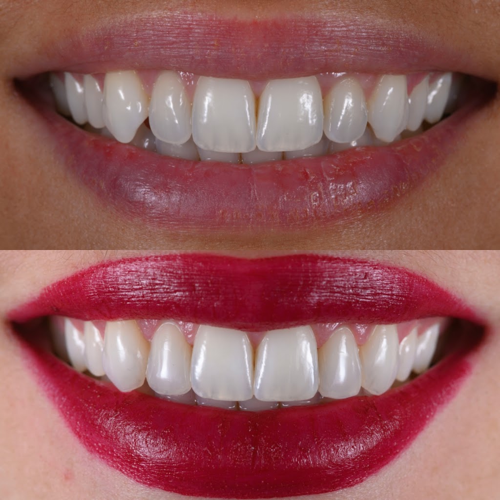 R Dentists | 6733 Mississauga Rd Suite102, Mississauga, ON L5N 6J5, Canada | Phone: (905) 567-6757