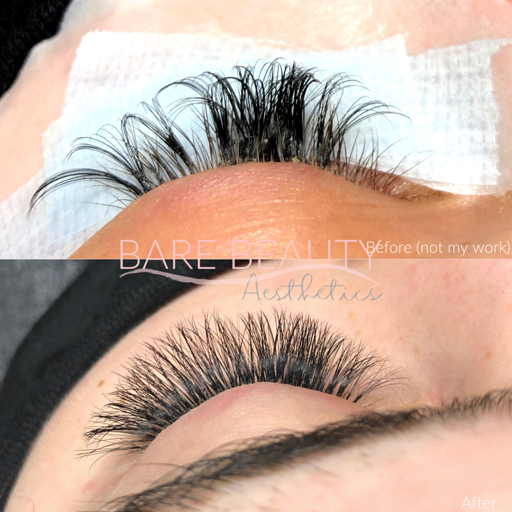 Bare Beauty Aesthetics | 976 Shadeland Ave #3, Burlington, ON L7T 2M5, Canada | Phone: (289) 208-3634
