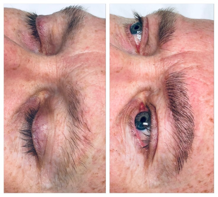 iBrow & Laser Clinic | 1595 Bedford Highway Suite 228, Sunnyside Mall, Bedford, NS B4A 3Y4, Canada | Phone: (902) 406-9526