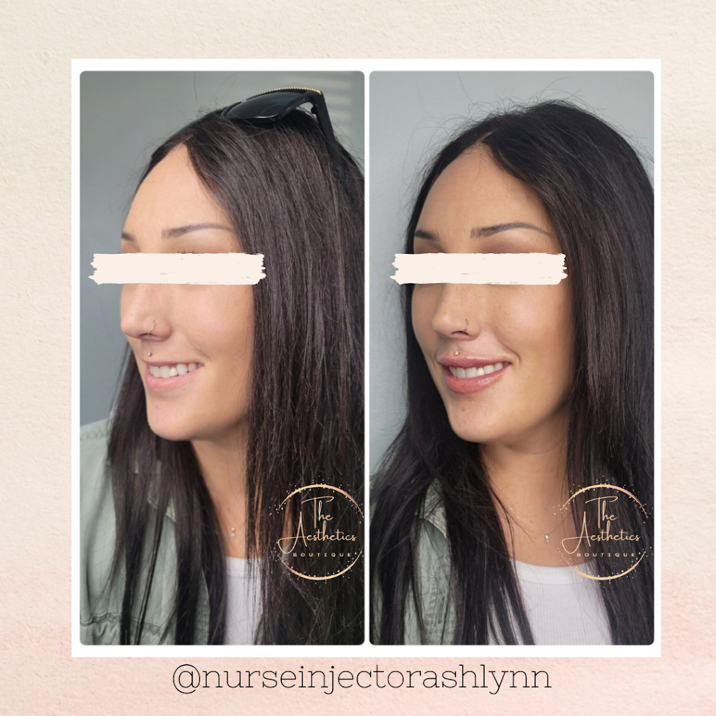The Aesthetics Boutique | 64 Viking Dr, Binbrook, ON L0R 1C0, Canada | Phone: (289) 921-8240