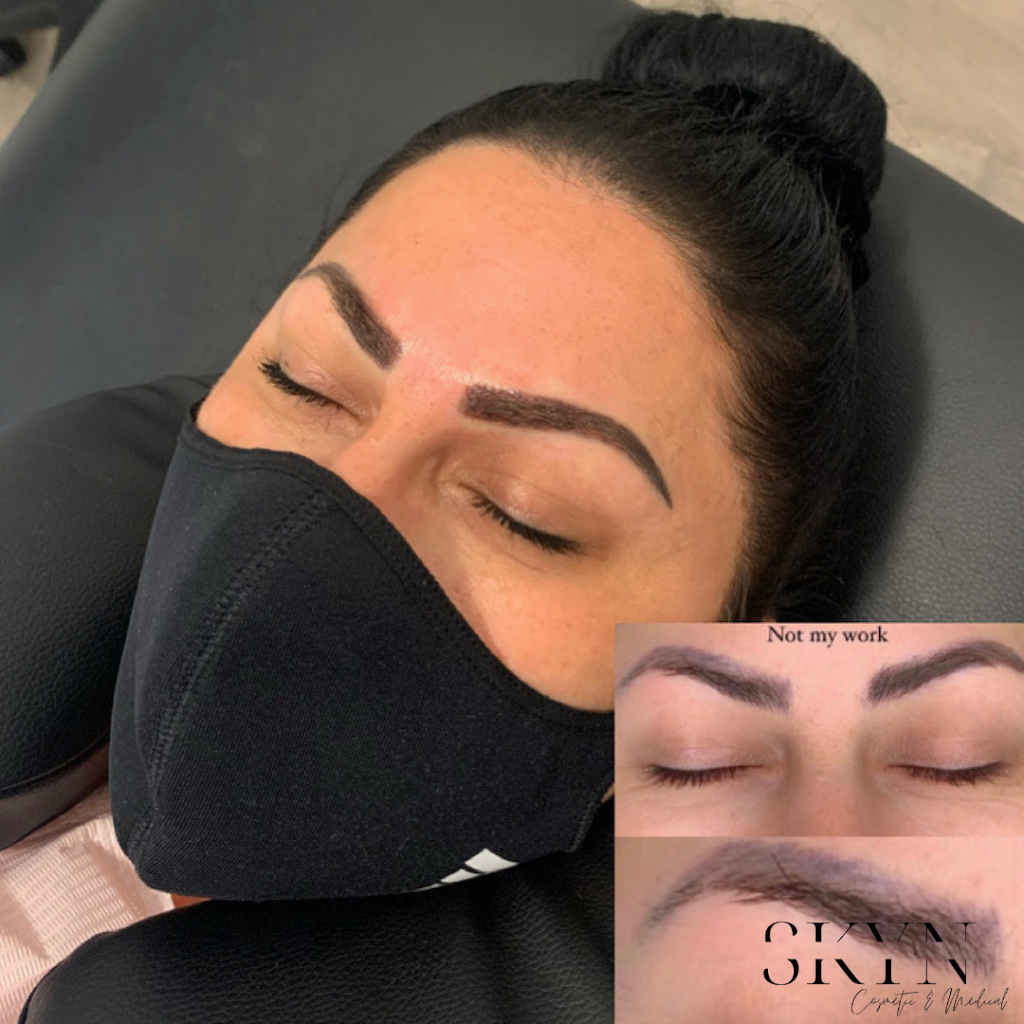 SKYN Cosmetic & Medical Studio | 5920 Turney Dr, Mississauga, ON L5M 2R8, Canada | Phone: (905) 812-0513