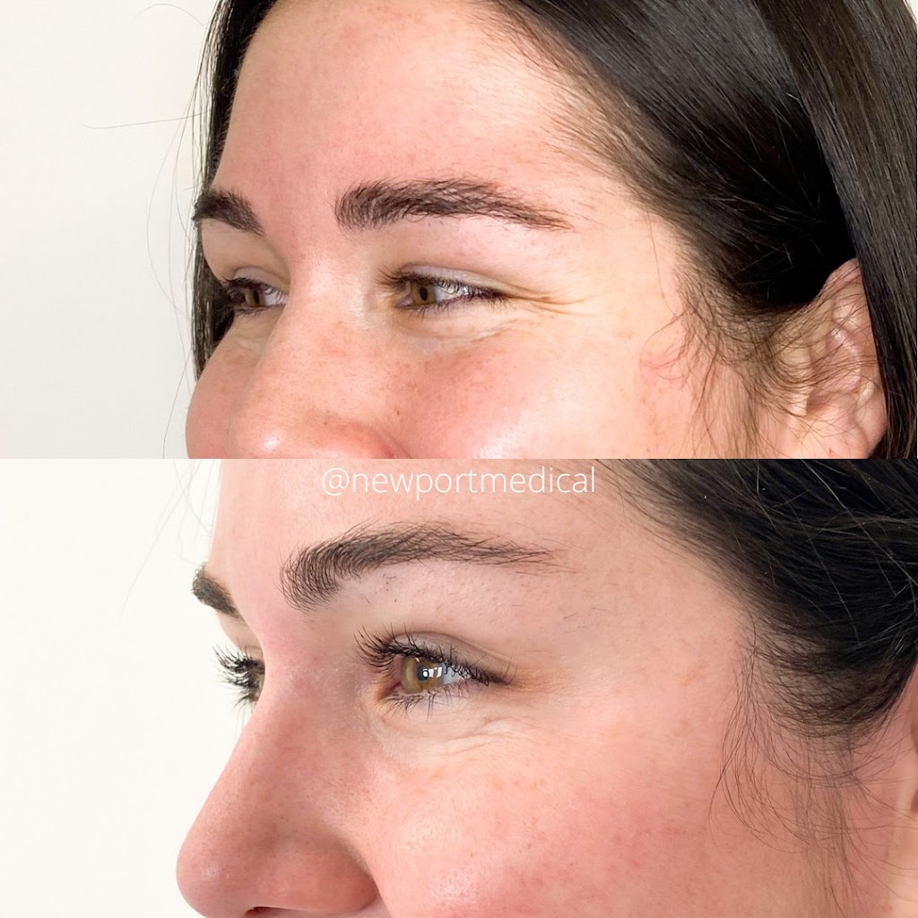 Newport Medical | 1551 Delia Crescent, Orléans, ON K4A 2X9, Canada | Phone: (613) 319-6706