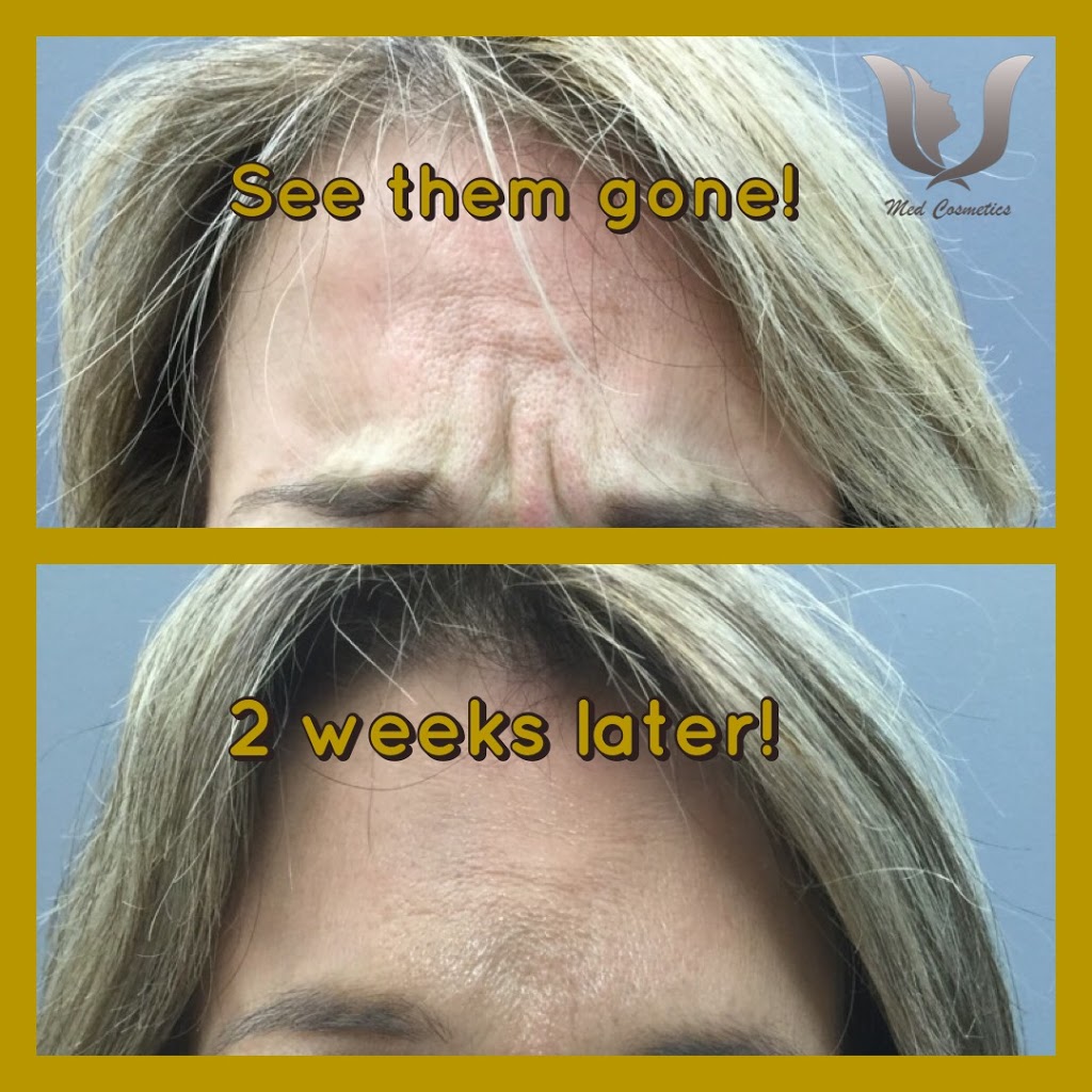 Med Cosmetics Clinic | 7700 Bathurst St #200, Thornhill, ON L4J 7Y3, Canada | Phone: (905) 597-5111