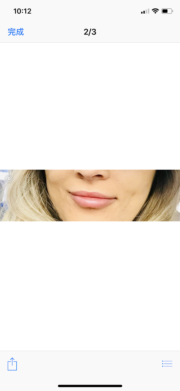 Fountain Laser Clinic | 9425 Leslie St #14a, Richmond Hill, ON L4B 3N7, Canada | Phone: (416) 625-1736