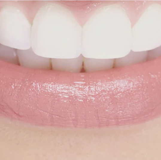 Queen Roncy Dental | 27 Roncesvalles Ave #507, Toronto, ON M6R 3B2, Canada | Phone: (416) 531-8887