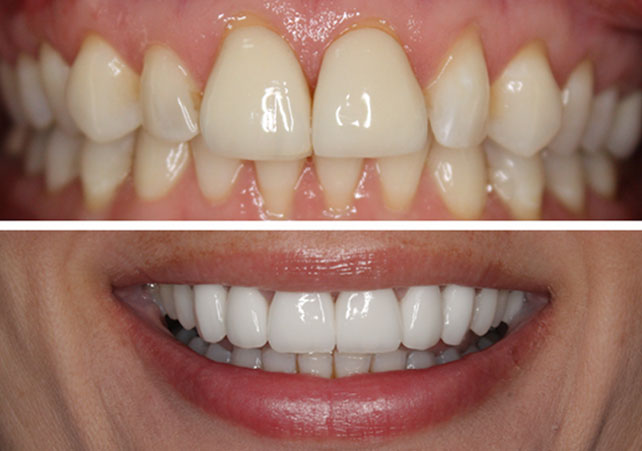 Molson Park Dental | Your Barrie Dentist | 33 Mapleview Dr W, Barrie, ON L4N 9H5, Canada | Phone: (705) 722-4848