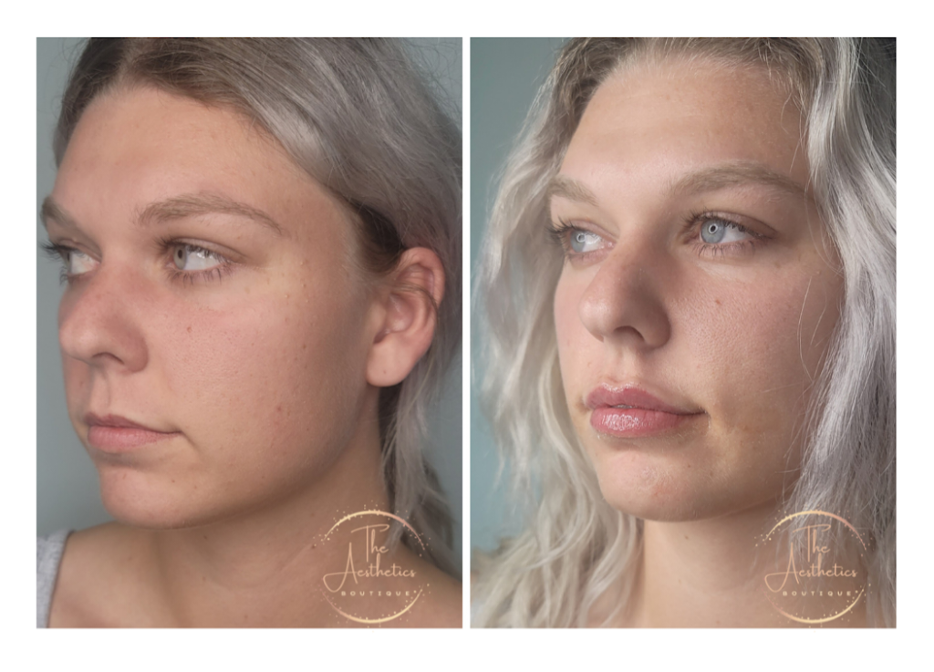 The Aesthetics Boutique | 64 Viking Dr, Binbrook, ON L0R 1C0, Canada | Phone: (289) 921-8240