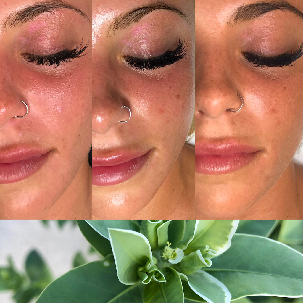AVÄYA Skin | 875 Bank St suite 3, Ottawa, ON K1S 3W4, Canada | Phone: (647) 963-0550