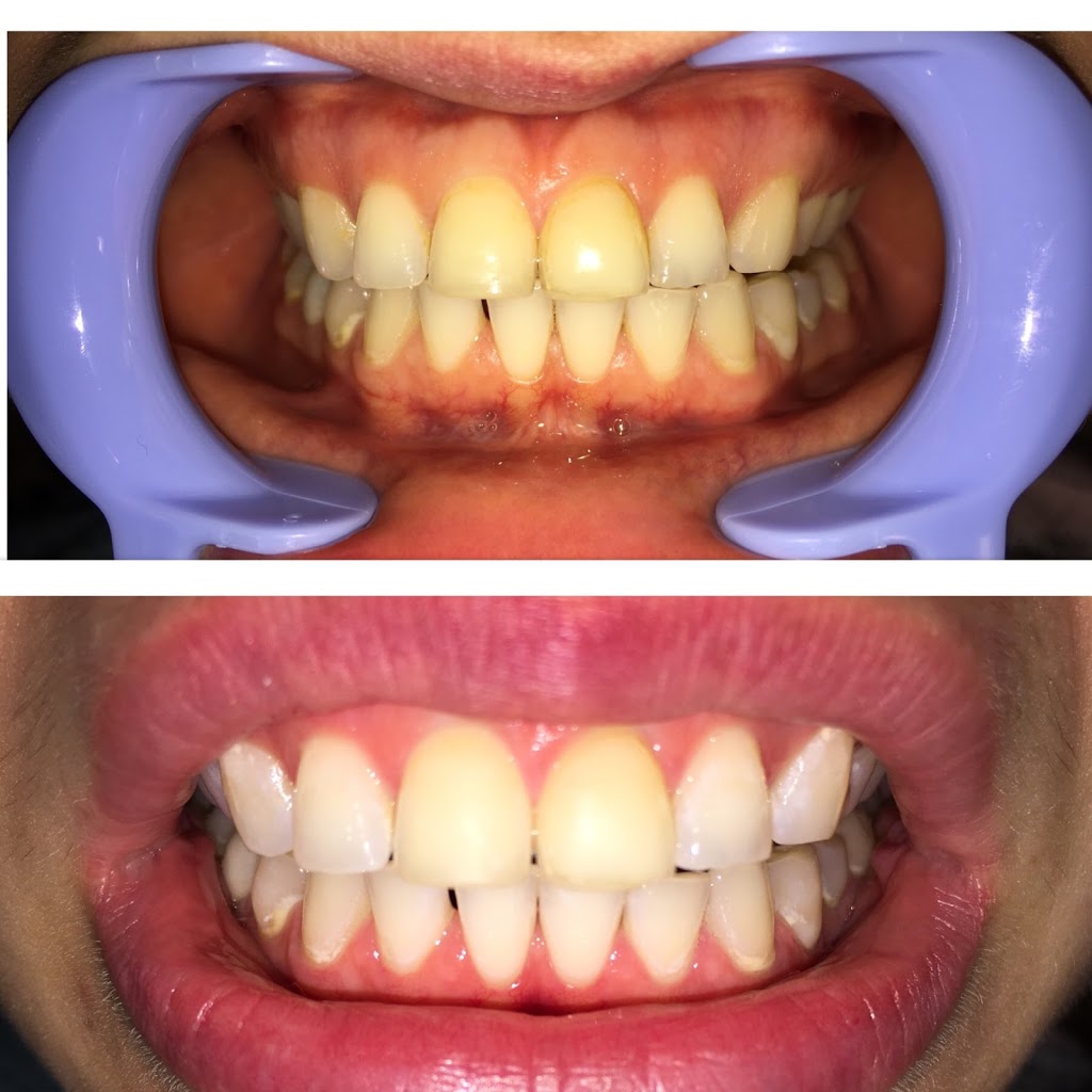 Bright and Bronze | 11502 Burnett St #7, Maple Ridge, BC V2X 0Y2, Canada | Phone: (604) 552-3173