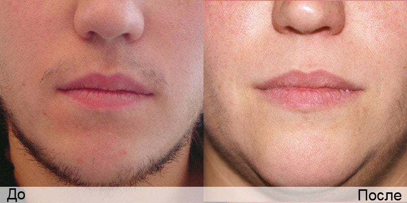 Skin Care Lazer YXE | Sunsera Salon. Ask for Olga (Laser technician, 815 Gray Ave, Saskatoon, SK S7N 2K6, Canada | Phone: (639) 318-9969