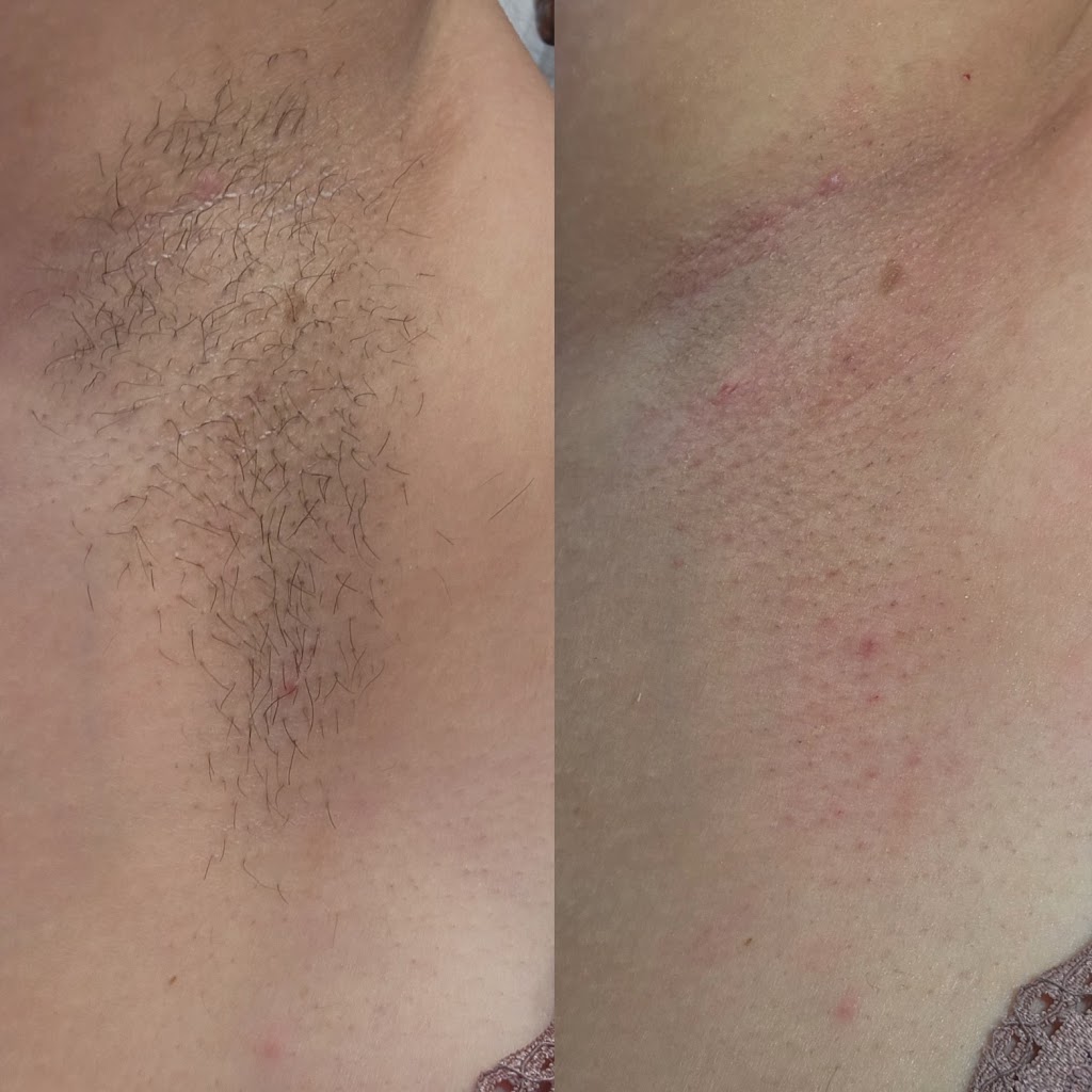 KNL Esthetics | 2414 16 Ave NW #350, Calgary, AB T2M 0M5, Canada | Phone: (403) 519-0413