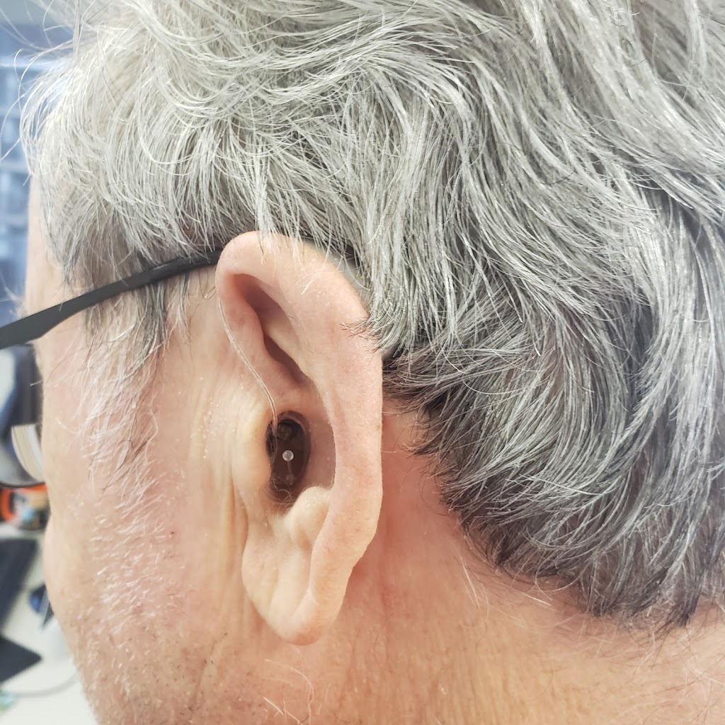Audiology Innovations Ltd | 320 23 Ave SW #202, Calgary, AB T2S 0J2, Canada | Phone: (403) 252-4722