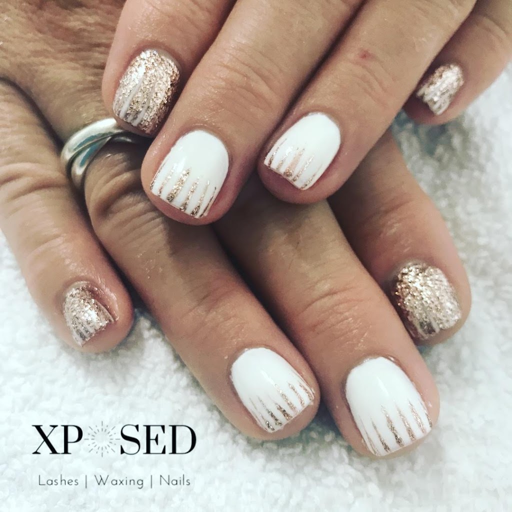 Xposed Esthetics | 529 Baycroft Dr, Martensville, SK S0K 2T2, Canada | Phone: (306) 203-4643