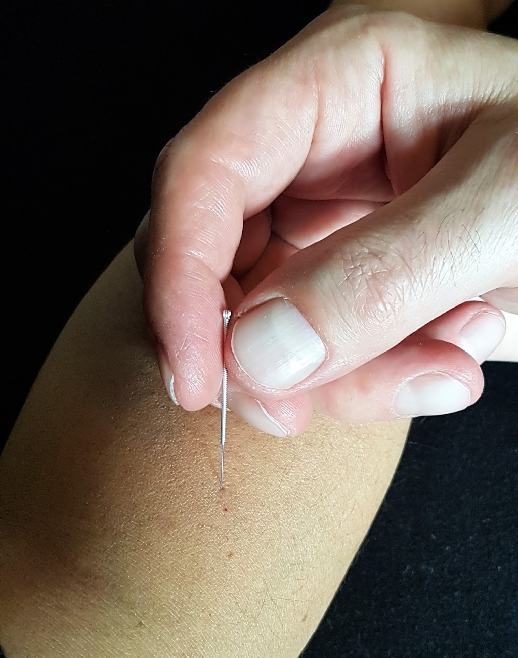 Qi Wave Acupuncture & Herbs | 40 Deermont Rd SE, Calgary, AB T2J 5T5, Canada | Phone: (403) 903-7307